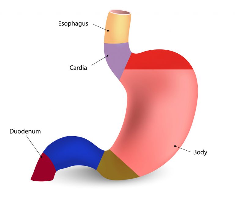 Behind The Headlines: Questions about AICR’s Stomach Cancer Report ...