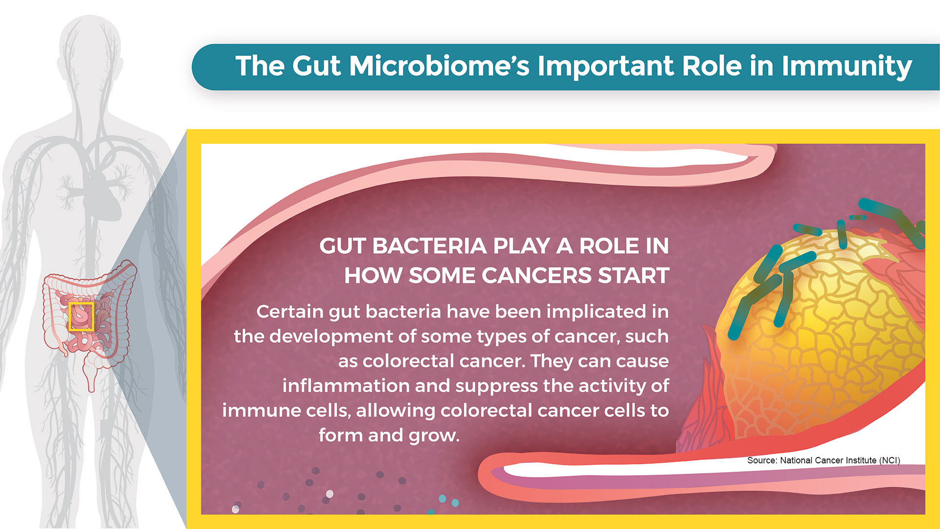 Diet The Gut Microbiome And Colorectal Cancer Connecting The Dots American Institute For